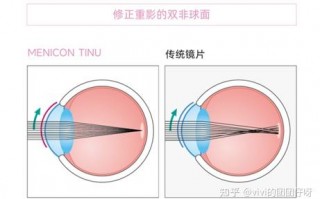 目立康隐形眼镜怎么样，目立康隐形眼镜怎么样好用吗